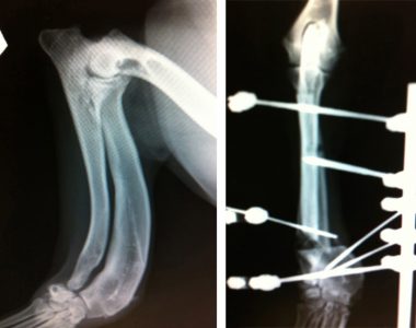 diorthotikes-osteotomes-3